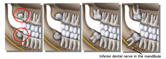 dentsdesagesse en