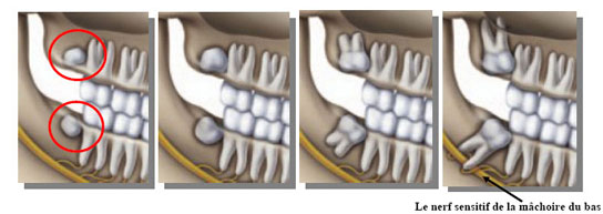 dentsdesagesse