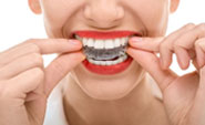 orthodontie3